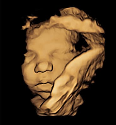 Feature Image